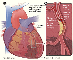 heart coronary artery