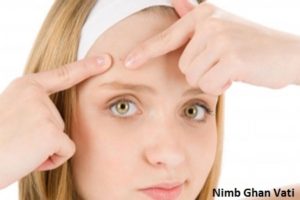 natural remedies for pimples