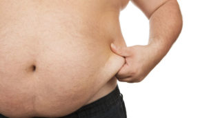 Natural Obesity Treatment and Management Program