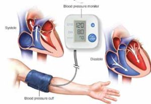 What is high blood pressure