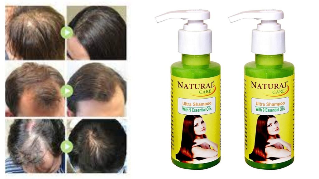 Natural Care Ultra Shampoo